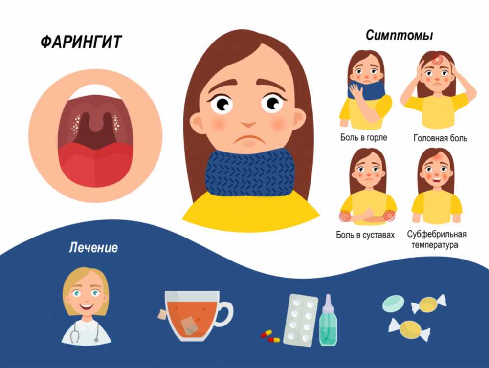 Фарингит у детей: симптомы, диагностика и лечение