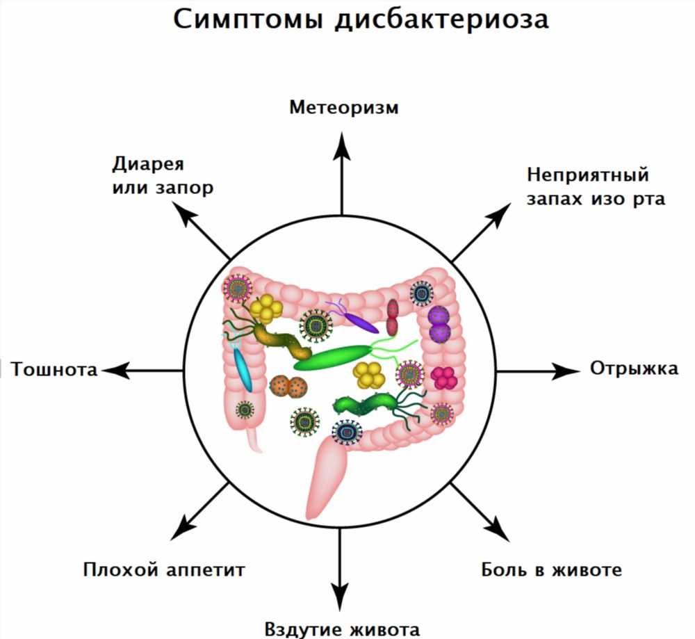 Как справиться с дисбактериозом: советы и рекомендации