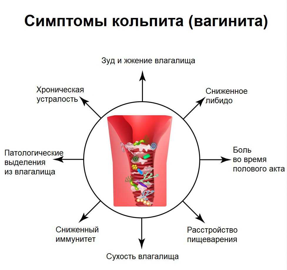 Патологические причины выделений: анализ в зависимости от характера