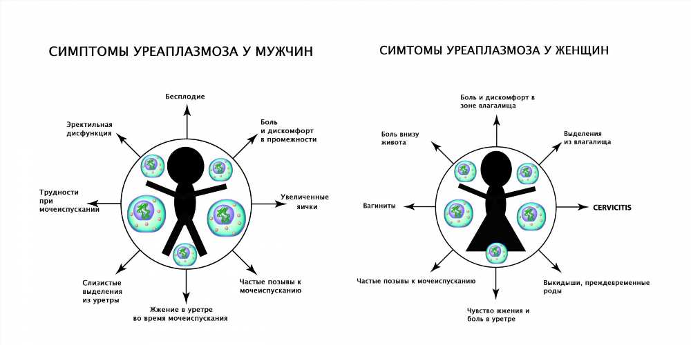 Почему возникает уреаплазмоз: основные причины и способы предотвращения