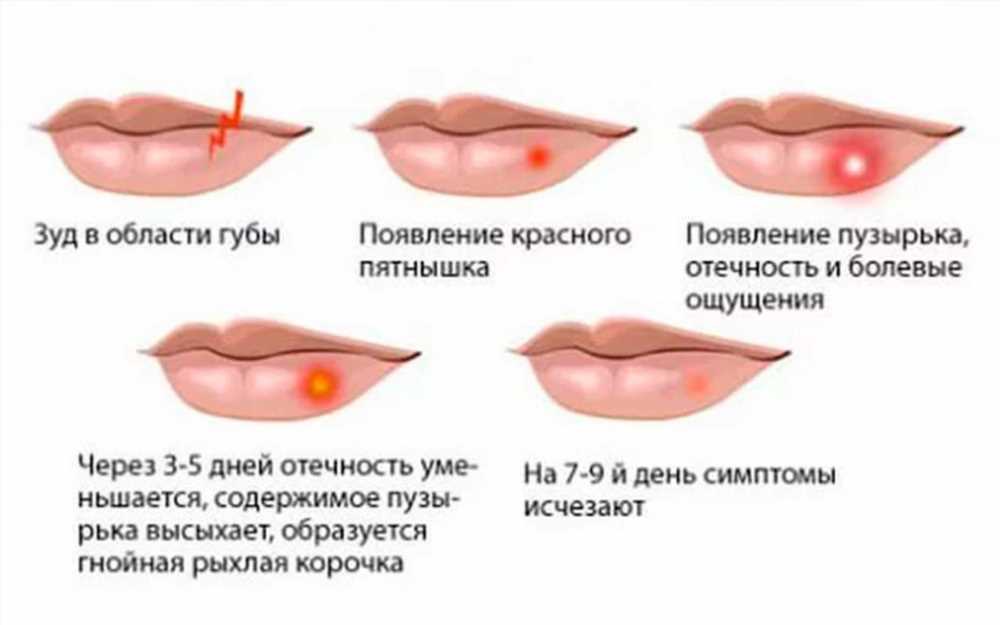 Полный гид по типам и проявлениям головных болей: разбираемся в симптомах и способах их устранения