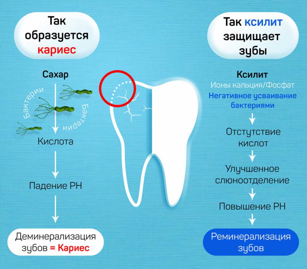 Защита от кариеса: Разбираемся, могут ли зубные пасты помочь